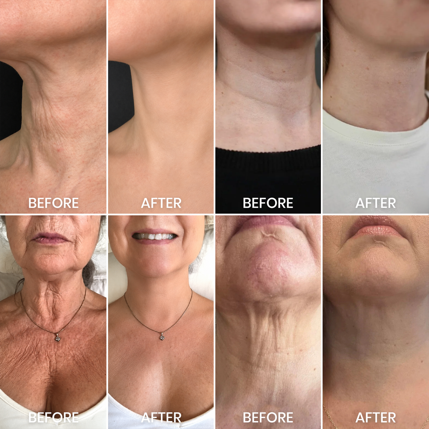 Luhaka® Instant Neck Lift Massage Roller Cream