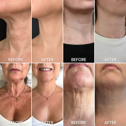 Luhaka® Instant Neck Lift Massage Roller Cream