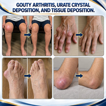 Lyyeto® TriMag Complex JOINT THERAPY CREAM