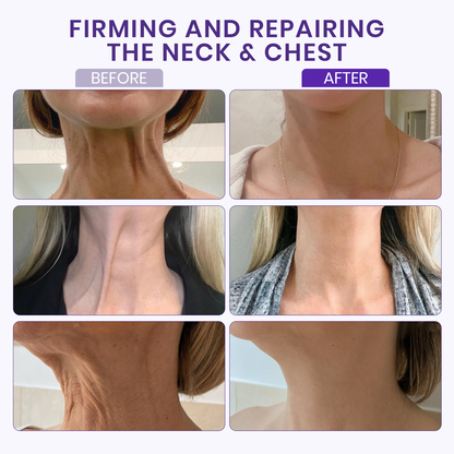 Luhaka® Instant Neck Lift Massage Roller Cream