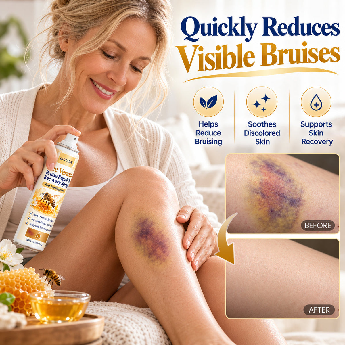 LUHAKA® Bee Venom Bruise Repair & Recovery Spray