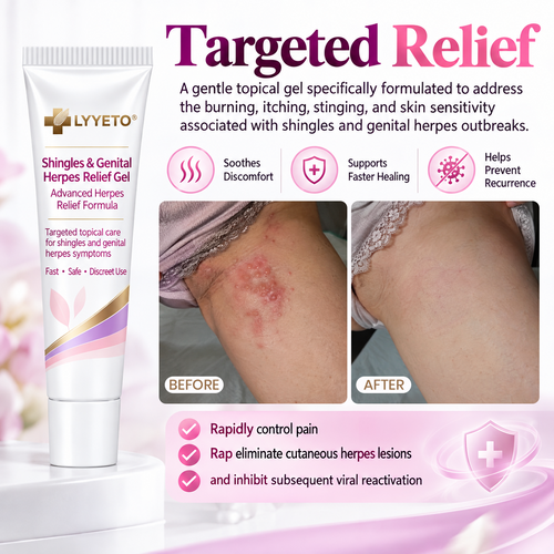 LYYETO®SHINGLES & GENITAL HERPES RELIEF GEL