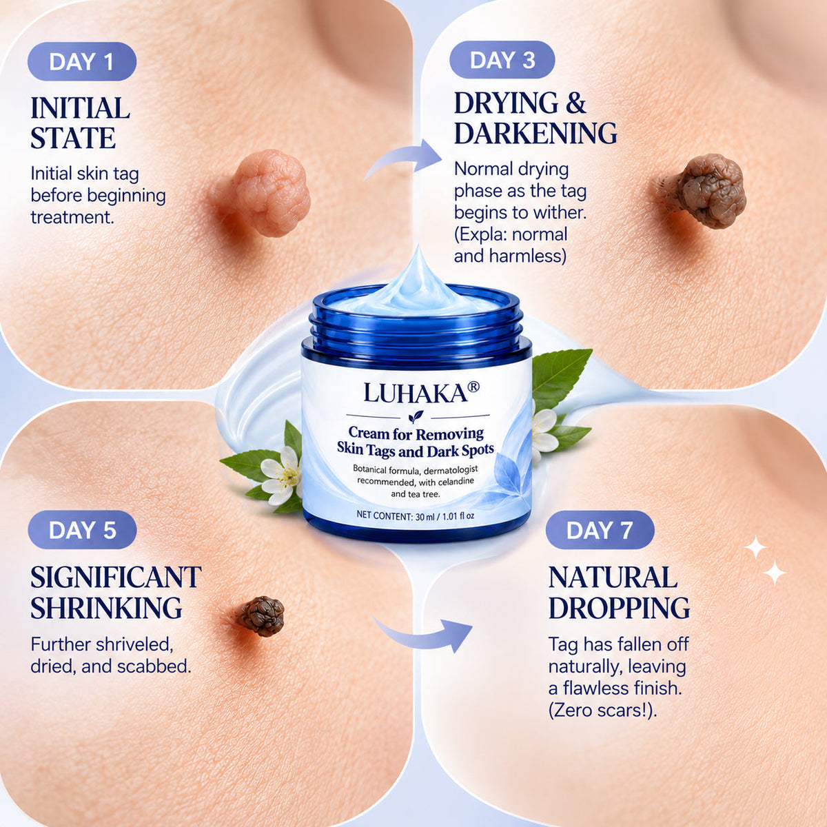 LUHAKA® Cream for Removing Skin Tags and Dark Spots