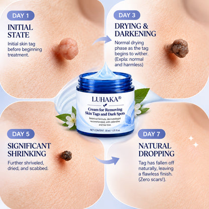LUHAKA® Cream for Removing Skin Tags and Dark Spots