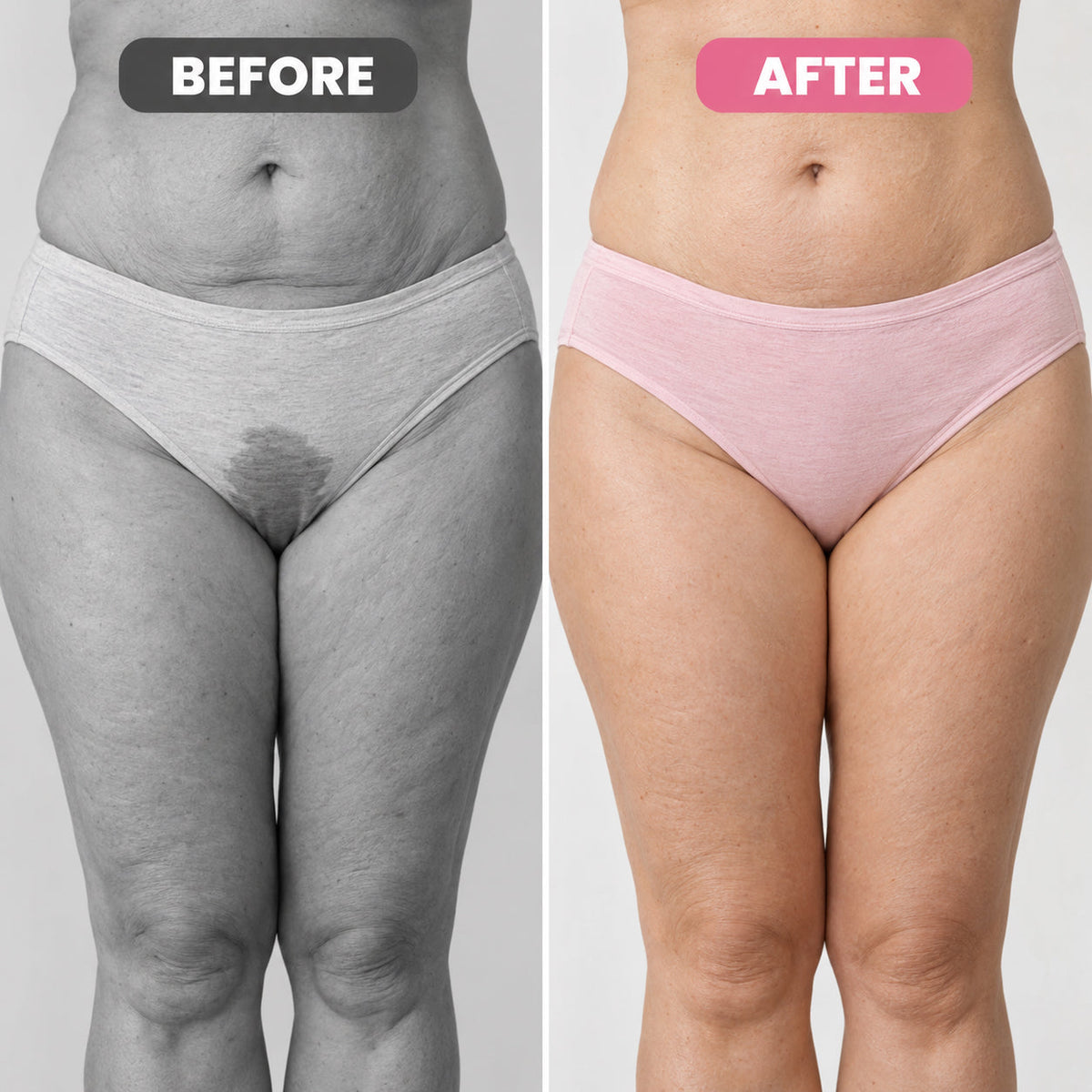 VibraPelvi™– Pelvic Floor Trainer