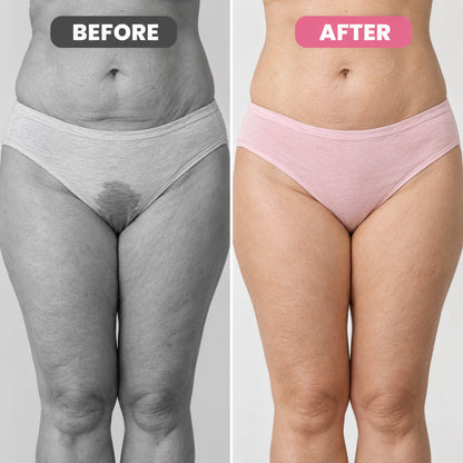 VibraPelvi™– Pelvic Floor Trainer