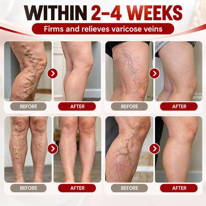 LUHAKA®Advanced Vein & Leg Care Cream