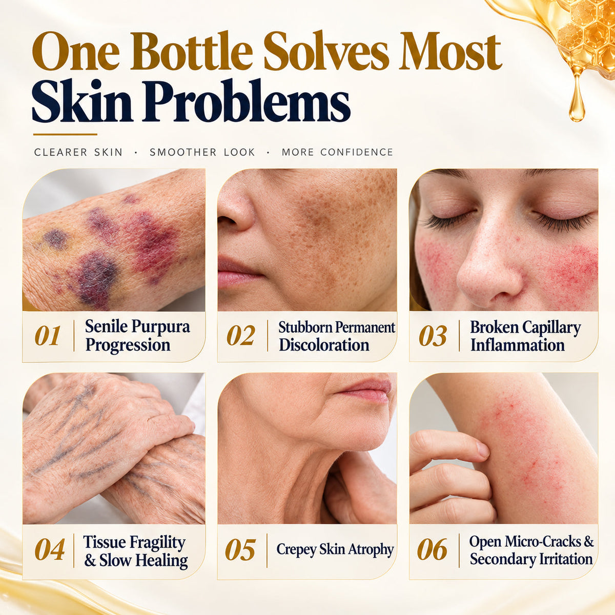 LUHAKA® Bee Venom Bruise Repair & Recovery Spray