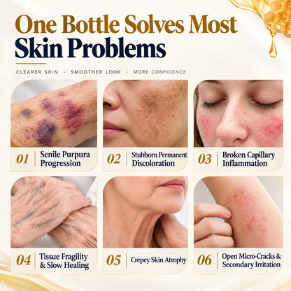 LUHAKA® Bee Venom Bruise Repair & Recovery Spray