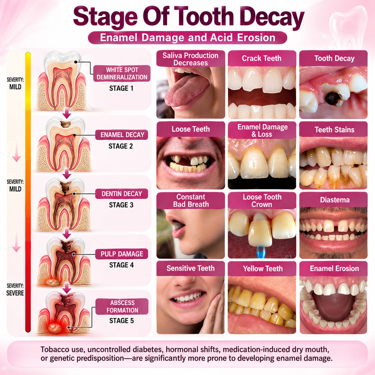 LUHAKA® DenPerm Cavity-Repair Gel