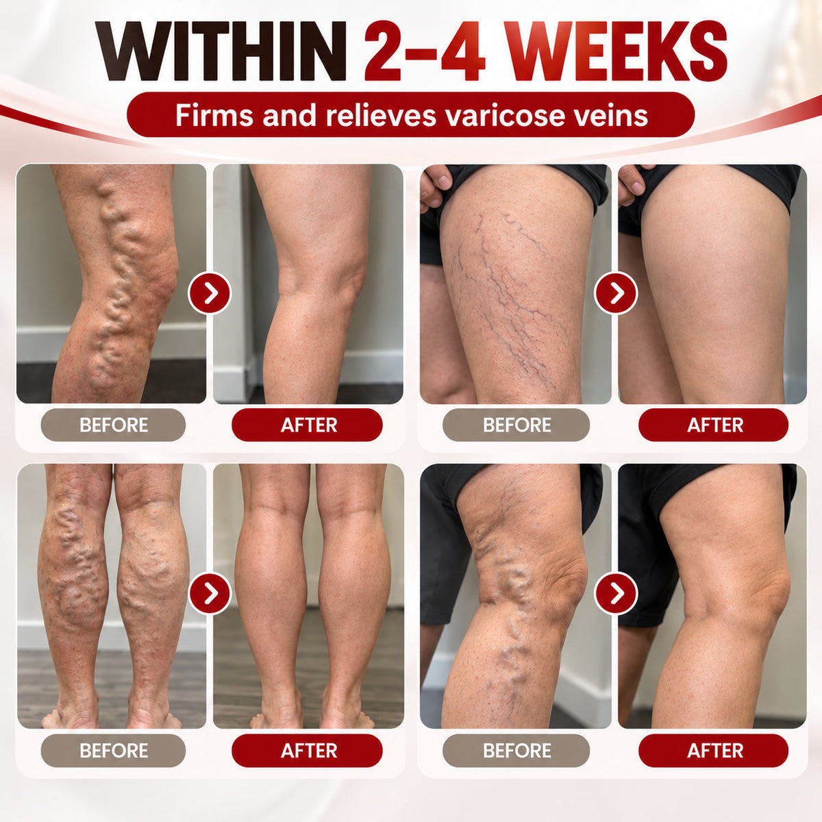 LUHAKA®Advanced Vein & Leg Care Cream