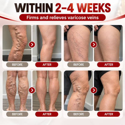LUHAKA®Advanced Vein & Leg Care Cream